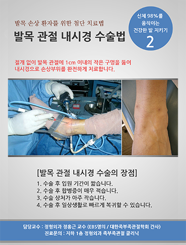 발목 관절 내시경 수술